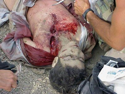 File:Omar Khadr getting battlefield first aid.jpg