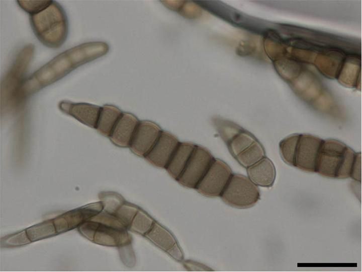 File:Alternaria brassicicola conidia3.jpg