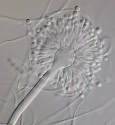 File:Aspergillus versicolor.jpeg