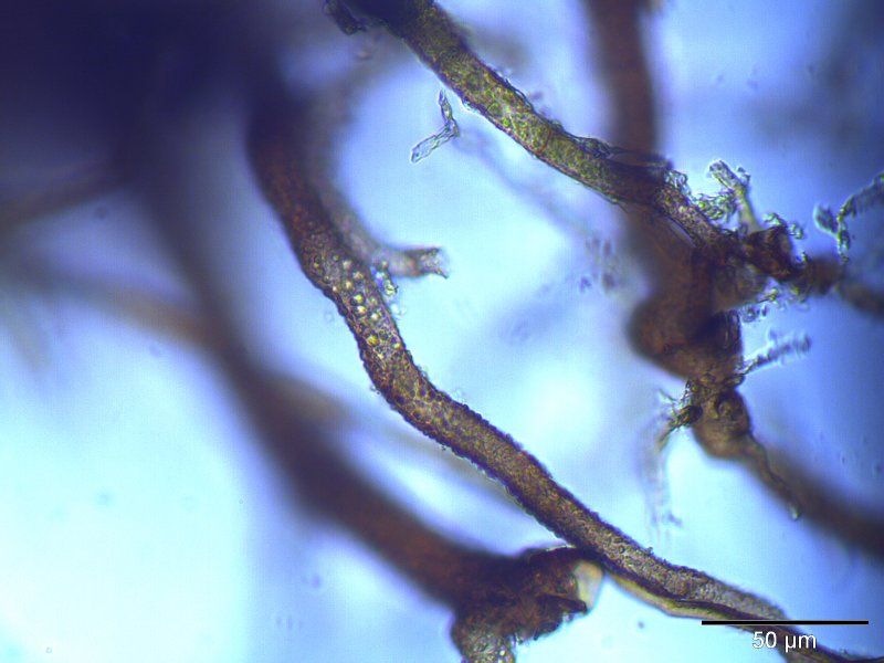 File:Bryum elegans rhizoide.jpeg