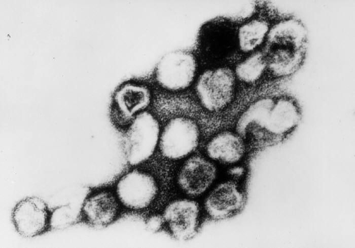 File:Rubella virus TEM B82-0203 lores.jpg