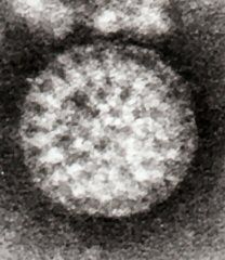 File:Flewett Rotavirus.jpg