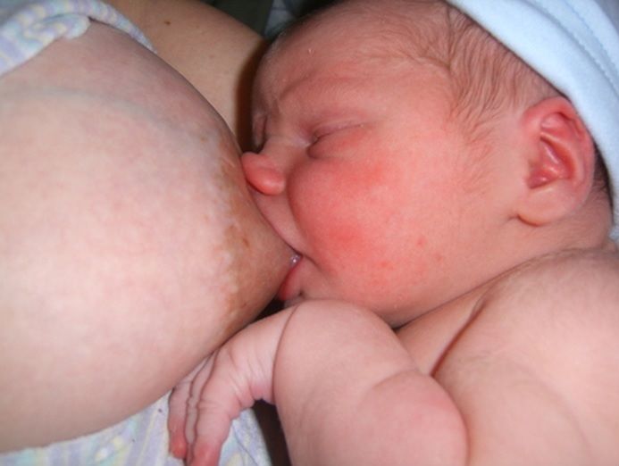 File:Poor breastfeeding latch.jpg