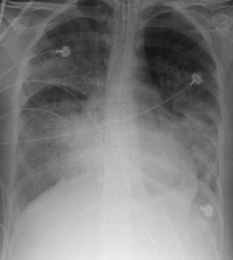 File:AARDS X-ray cropped.jpg