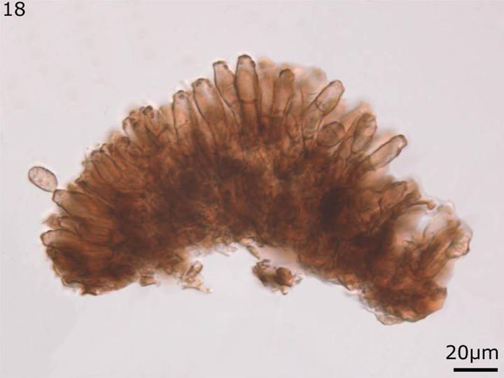 File:Asperisporium caricae conidiophores and conidium.jpg