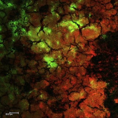 File:Intraorally developed biofilm.jpg