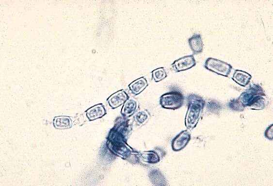 File:Arthroconidia of Coccidioides immitis 39G0040 lores.jpg