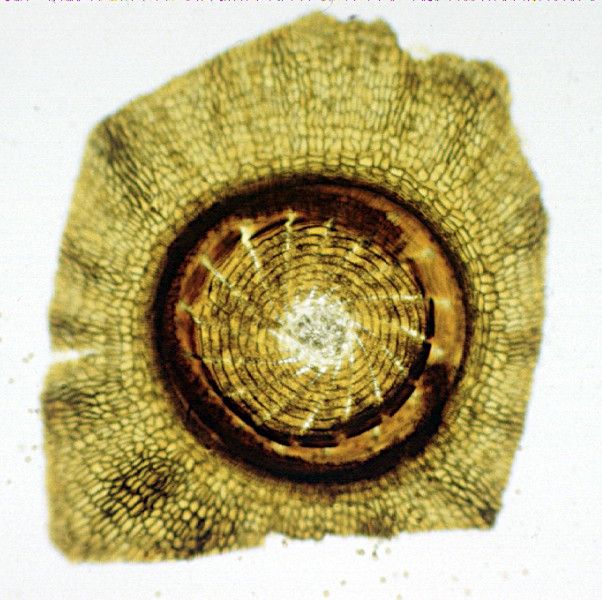 File:Moss peristome WM.jpg