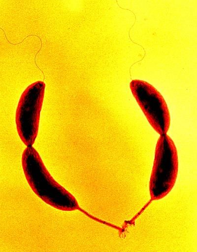 File:Caulobacter crescentus.jpg