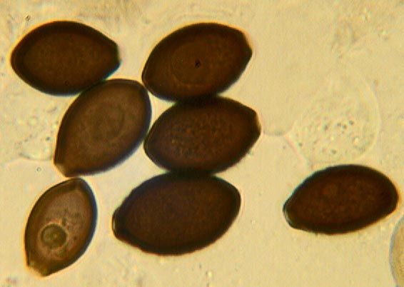 File:Panaeolus castaneifolius.spores.jpg