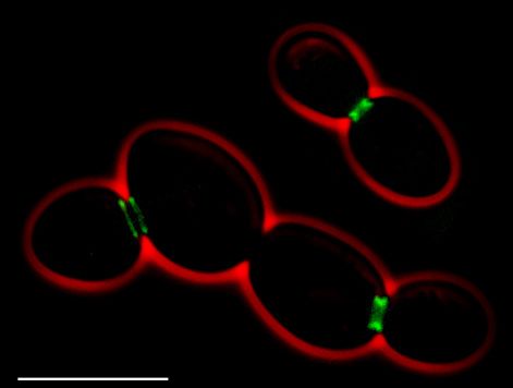 File:S cerevisiae septins.jpg