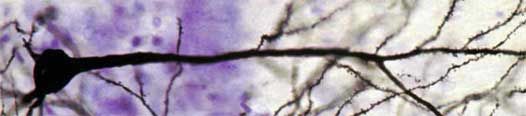 File:Neuron upclose.jpg