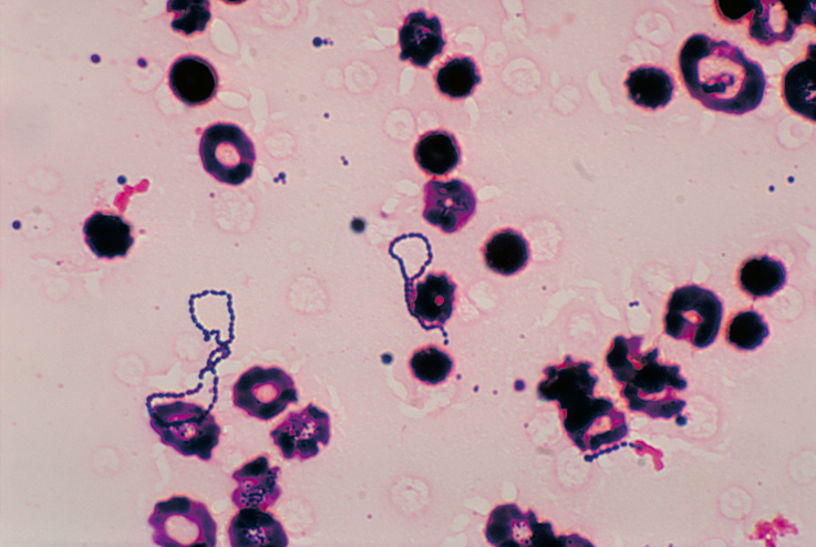 File:Streptococcus viridans 01.png