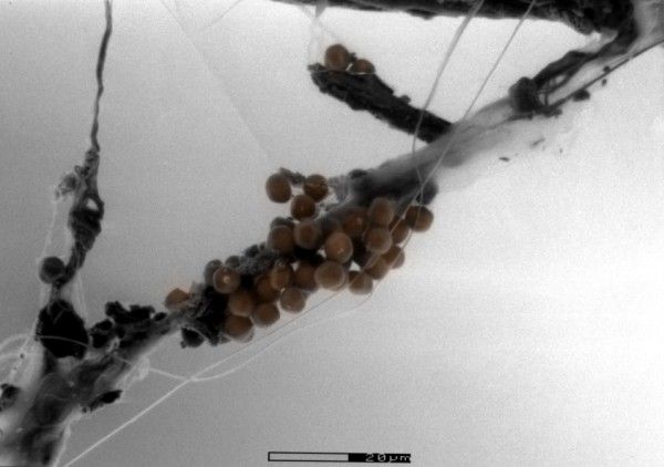 File:Fungal spores in spiders web.jpg