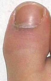 File:Big toe.JPG