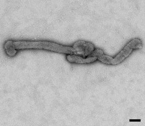 File:Bourbon virus filament (EID 2015 Fig 2a).jpg