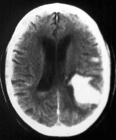 File:Mri041b2.jpg