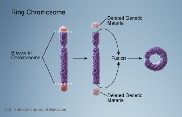 File:NLM ring chromosome.jpg