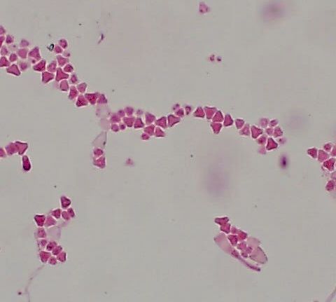 File:Anthopsis deltoidea spores.jpg