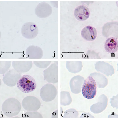 File:Plasmodium knowlesi smears IDC.png