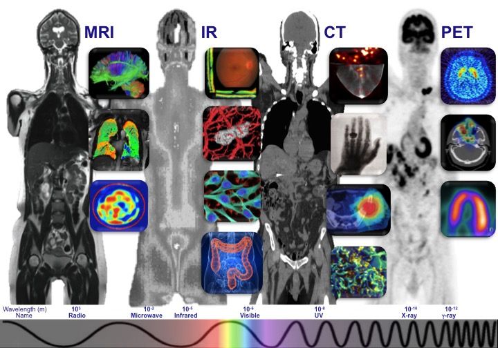 File:TORNAI-SpectrumOfMedicalImaging.jpg