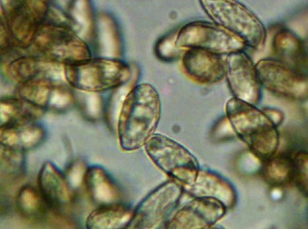 File:Gomphus floccosus spores.jpg