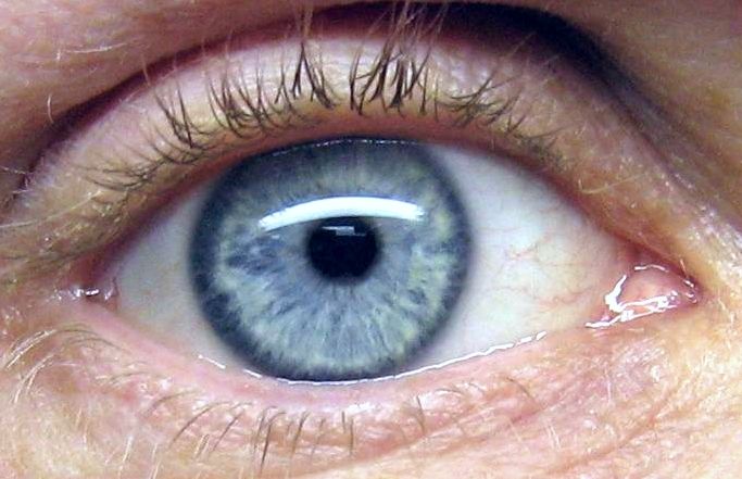 File:Auge IMG 4057-2.jpg