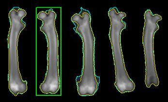 File:Bone Density.jpg