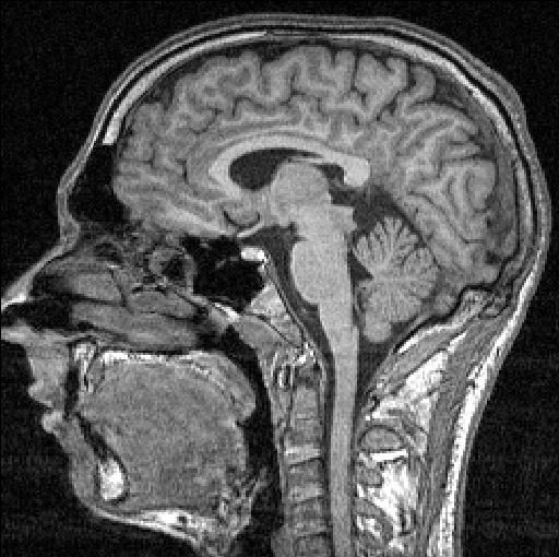 File:FMRI-scan sectie 85.JPG