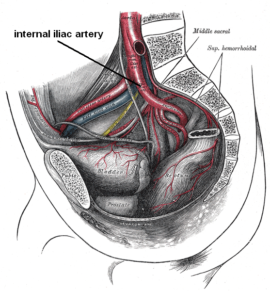 File:Internaliliac.png