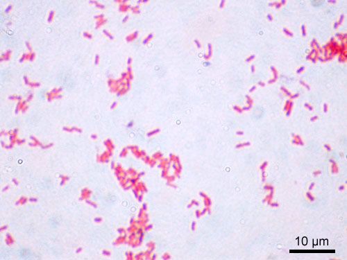 File:Escherichia coli Gram.jpg