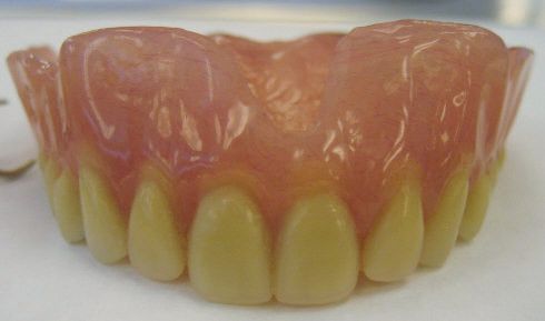 File:Mr M's Complete Denture2.jpg