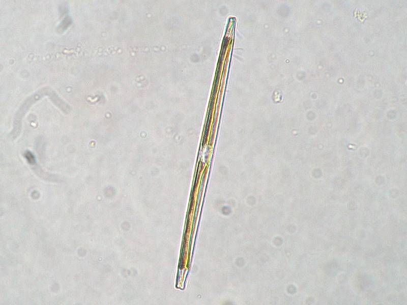 File:Nitzschia sp.jpeg