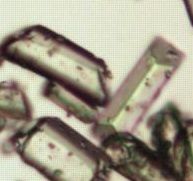 File:Struvite crystals.jpg