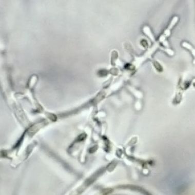 File:Trichophyton rubrum microconidia.jpg