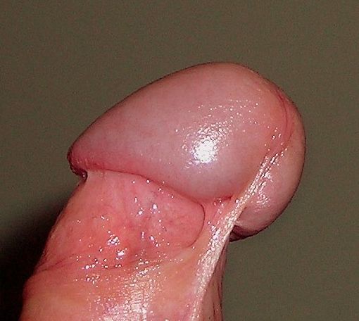 File:Penisfrenulum.jpg