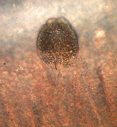 File:Trophont of Amyloodinium ocellatum.png