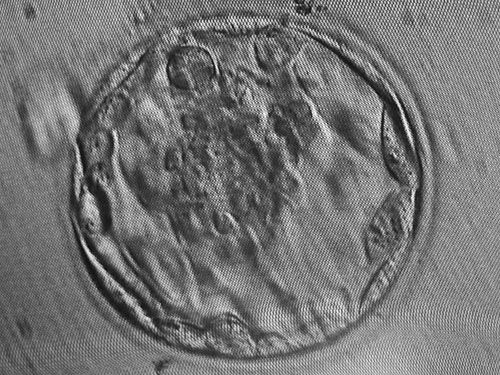 File:Blastocyst.JPG