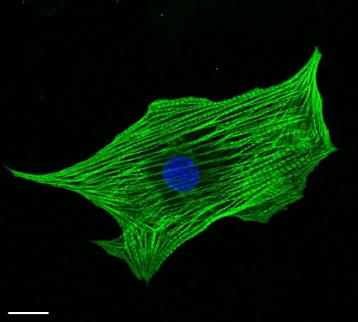 File:Embryonal cardiac stem cellתמונה2.jpg