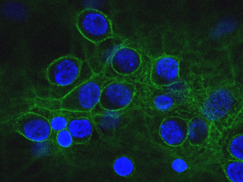 File:Spectrin localization under the neuronal plasme membrane..jpg