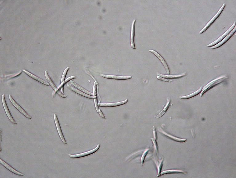 File:Fusarium solani (Mart.) Sacc. 5393379.jpg