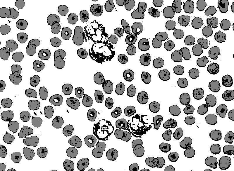 File:Neutrophils-hue-threshold-linear.jpg