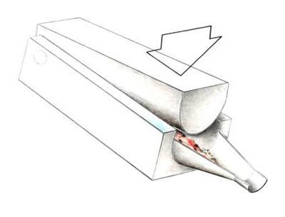 File:Paste Graft Surgery-3.jpg