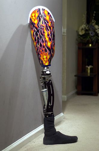 File:S-N-S flame leg.jpg