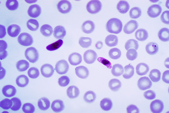 File:Plasmodium falciparum 01.png