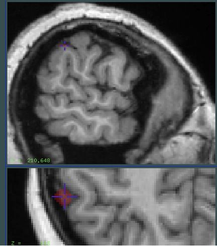 File:Brain1.jpg