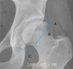 File:Crossing ratio of the hip.jpg