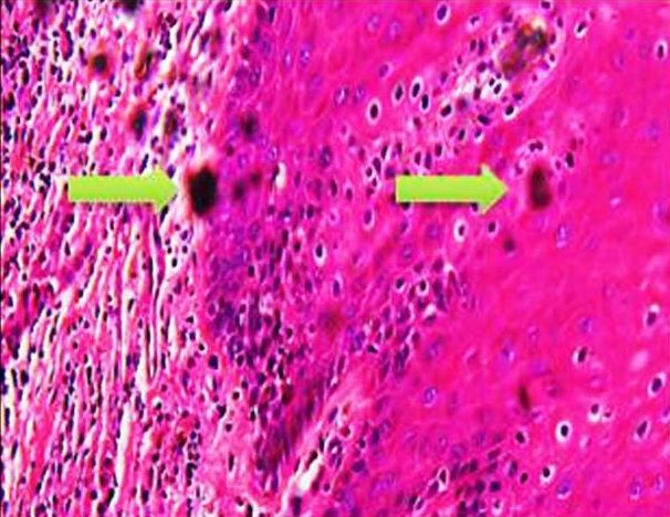 File:Formalin pigment artifacts.jpg