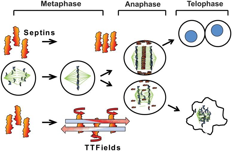 File:Septins and TTFields.jpg