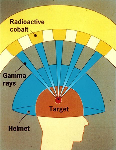 File:Gamma Knife Graphic.jpg